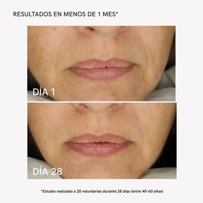 ELYSSIEN RF Facial Cream – Reduce Arrugas y Líneas de Expresión