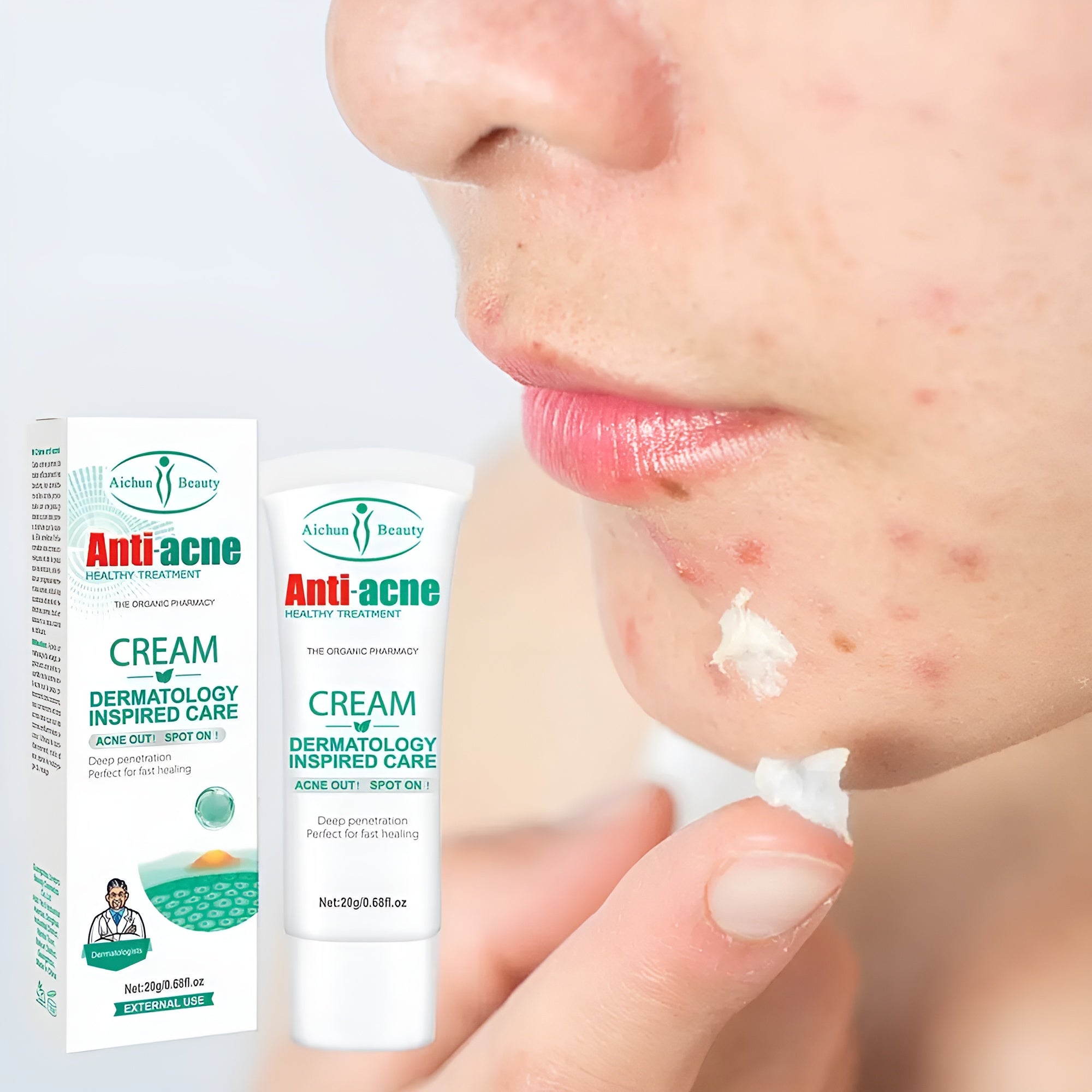 Aichun Beauty™ Anti-Acne Cream – Elimina Granos, Reduce Inflamación y Aclara la Piel Rápidamente