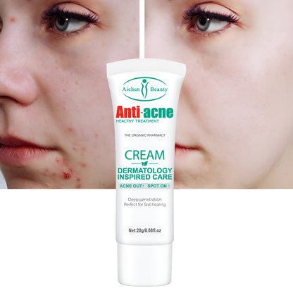 Aichun Beauty™ Anti-Acne Cream – Elimina Granos, Reduce Inflamación y Aclara la Piel Rápidamente