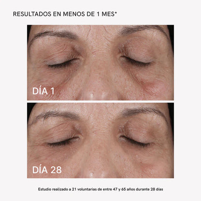 RF Face Device Plus